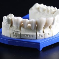 Affordable Dentures & implants in Bhandup