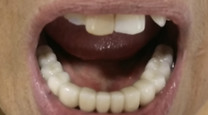 magicalsmiles after treatment