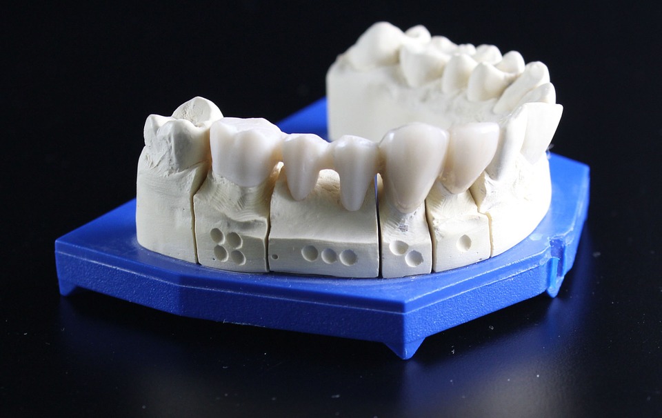 dental implants magicalsmiles