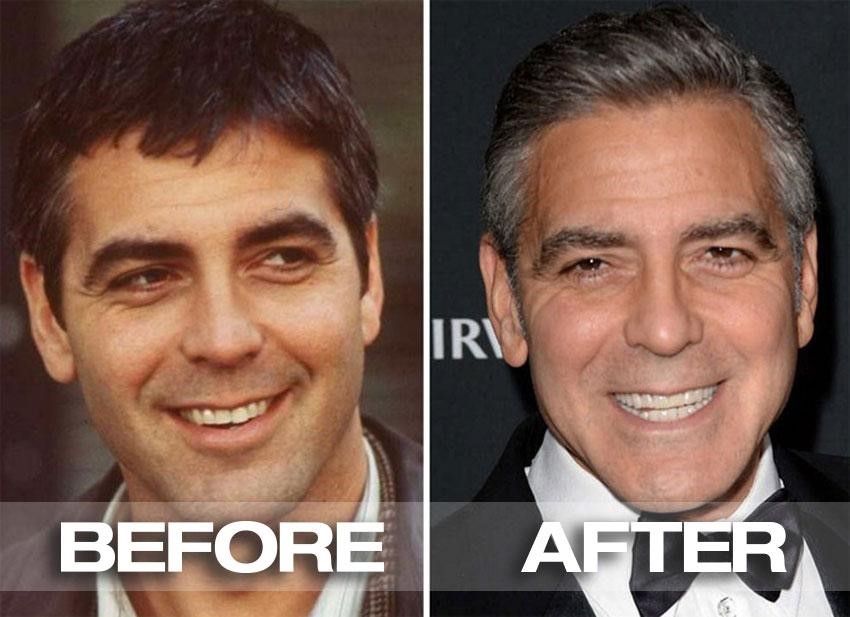 Celebrity Dental story