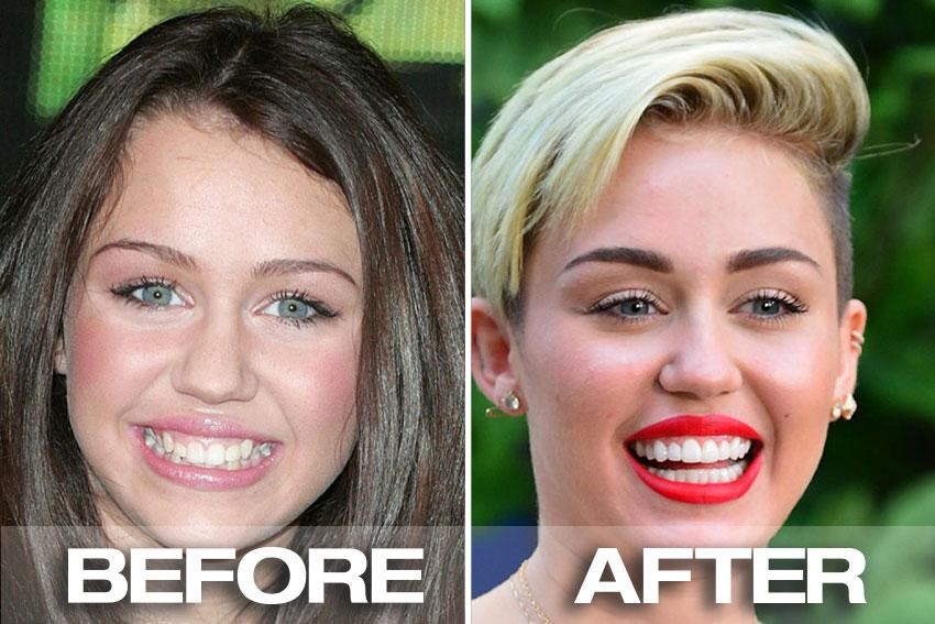 Celebrity Dental story