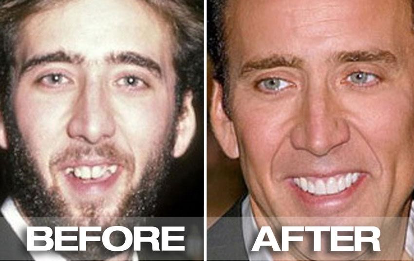 Celebrity dental story