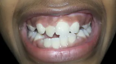 magicalsmiles before treatment