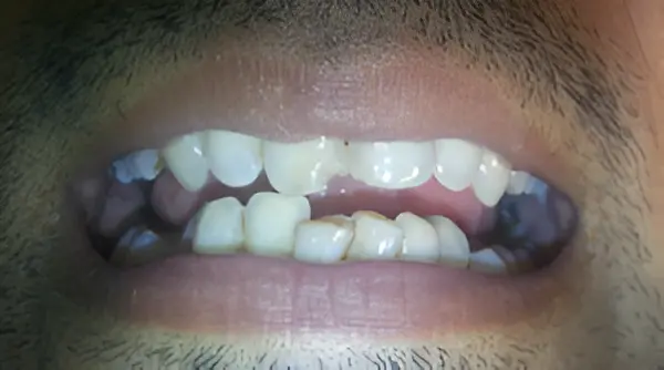 magicalsmiles before treatment