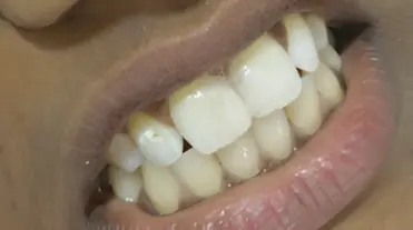 magicalsmiles after treatment