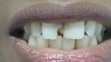 magicalsmiles before treatment