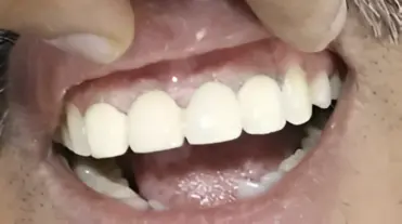 magicalsmiles after treatment