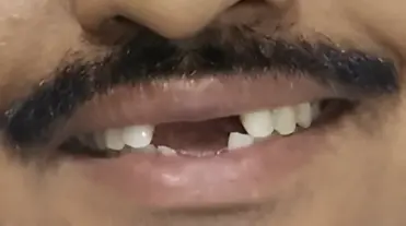 magicalsmiles before treatment