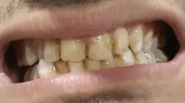 magicalsmiles before treatment